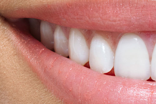 Ästhetische zahnheilkunde